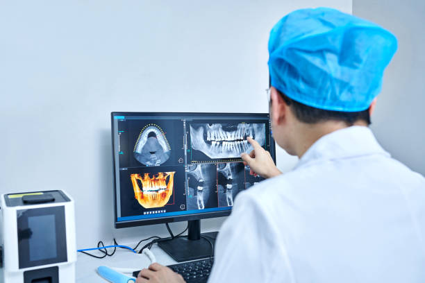 Best Emergency Dentist for Lost Fillings or Crowns in Bayshore Gardens, FL